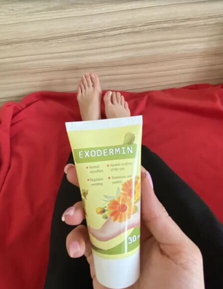 Panoramica della crema brand esodermin brand da Yesenia